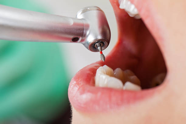 Best Broken Tooth Emergency  in Colorado City, TX